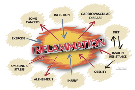 Inflammation - Acute can be a life saver, Chronic can lead to ill health